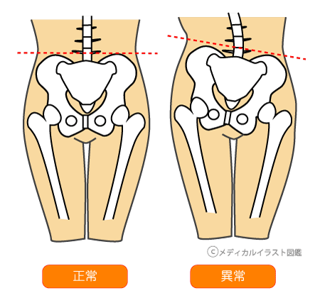 kosi